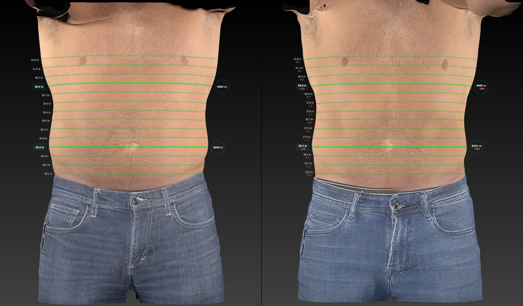 Example of measured body contouring progress